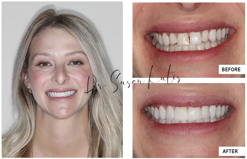 Cosmetic Dentistry LIttleton