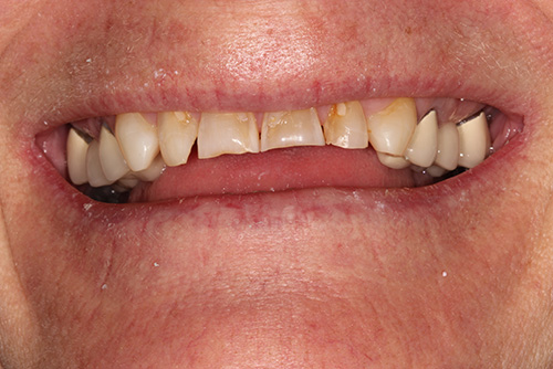 Patient Spotlight Littleton