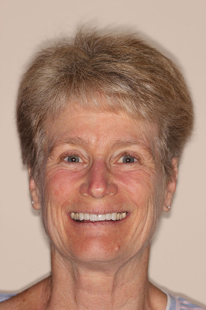Patient Spotlight Littleton
